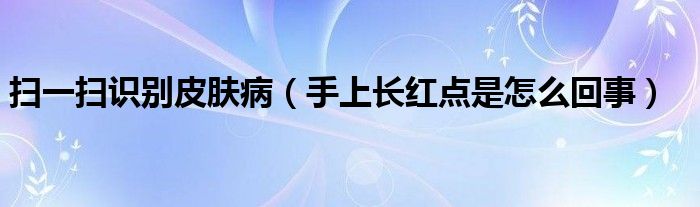 扫一扫识别皮肤病【手上长红点是怎么回事】