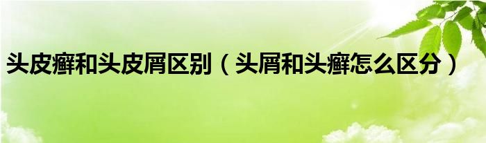 头皮癣和头皮屑区别【头屑和头癣怎么区分】