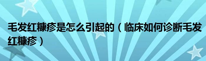 毛发红糠疹是怎么引起的【临床如何诊断毛发红糠疹】